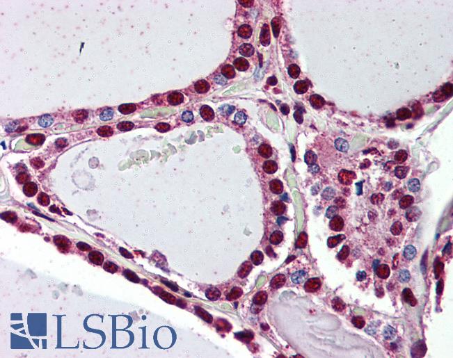 Anti-PROKR2 antibody LS-A3179 IHC of human thyroid. Immunohistochemistry of formalin-fixed, paraffin-embedded tissue after heat-induced antigen retrieval.