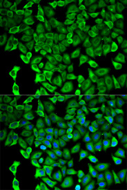 Immunofluorescence analysis of HeLa cell using PSMD2 antibody. Blue: DAPI for nuclear staining.