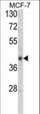 Western blot of SERPINA9 Antibody in MCF-7 cell line lysates (35 ug/lane). SERPINA9 (arrow) was detected using the purified antibody.