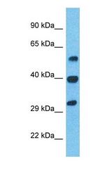 Western blot of ILEU Antibody with human Stomach Tumor lysate.