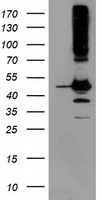 HEK293T cells were transfected with the pCMV6-ENTRY control (Left lane) or pCMV6-ENTRY SERPINB13 (Right lane) cDNA for 48 hrs and lysed. Equivalent amounts of cell lysates (5 ug per lane) were separated by SDS-PAGE and immunoblotted with anti-SERPINB13.