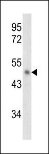 Western blot of PAI2 antibody in NCI-H460 cell line lysates (35 ug/lane). PAI2 (arrow) was detected using the purified antibody.