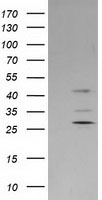 HEK293T cells were transfected with the pCMV6-ENTRY control (Left lane) or pCMV6-ENTRY SERPINB2 (Right lane) cDNA for 48 hrs and lysed. Equivalent amounts of cell lysates (5 ug per lane) were separated by SDS-PAGE and immunoblotted with anti-SERPINB2.