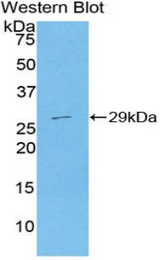 Western blot of recombinant SERPINB2 / PAI-2.