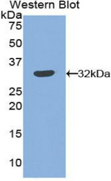 Western blot of recombinant SERPINB2 / PAI-2.