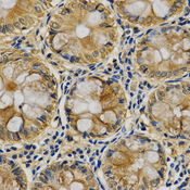Immunohistochemistry of paraffin-embedded human colon using SERPINB5 antibody at dilution of 1:200 (x400 lens)