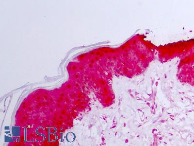 Anti-SERPINB5 / Maspin antibody IHC of human skin, epidermis. Immunohistochemistry of formalin-fixed, paraffin-embedded tissue after heat-induced antigen retrieval. Antibody LS-B7484 concentration 2.5 ug/ml.