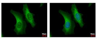 SERPINB6 antibody [N2C2], Internal detects SERPINB6 protein at cytoplasm by immunofluorescent analysis. HeLa cells were fixed in 4% paraformaldehyde at RT for 15 min. SERPINB6 protein stained by SERPINB6 antibody [N2C2], Internal diluted at 1:500.