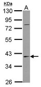 Sample (30 ug of whole cell lysate) A: NT2D1 10% SDS PAGE SERPINB7 antibody diluted at 1:1000