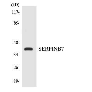 Western blot of the lysates from Jurkat cells using SERPINB7 antibody.