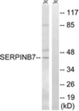 Western blot of extracts from Jurkat cells, using SERPINB7 Antibody. The lane on the right is treated with the synthesized peptide.
