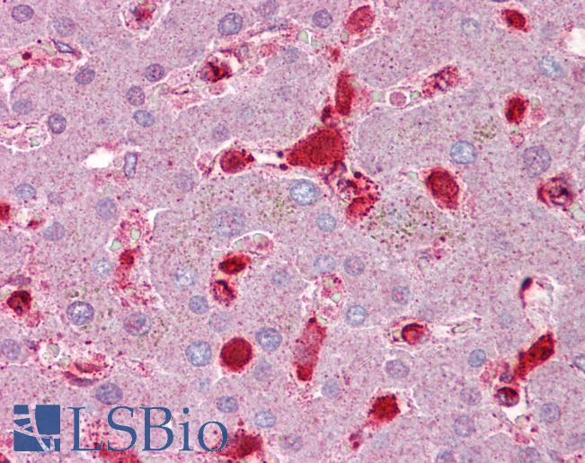Anti-Antithrombin III antibody IHC of human liver. Immunohistochemistry of formalin-fixed, paraffin-embedded tissue after heat-induced antigen retrieval. Antibody LS-B6624 concentration 5 ug/ml.