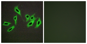 Immunofluorescence of HepG2 cells, using Heparin Cofactor II Antibody. The picture on the right is treated with the synthesized peptide.