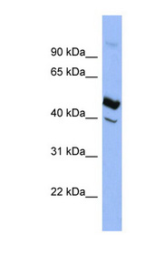 SERPIND1 / Heparin Cofactor II antibody LS-C107501 Western blot of THP-1 cell lysate.