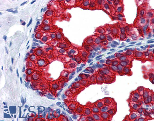 Anti-SERPINE1 / PAI-1 antibody IHC of human prostate. Immunohistochemistry of formalin-fixed, paraffin-embedded tissue after heat-induced antigen retrieval. Antibody LS-B3936 concentration 2.5 ug/ml.