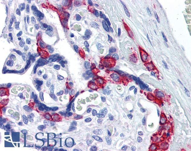 Anti-SERPINE1 / PAI-1 antibody IHC of human placenta. Immunohistochemistry of formalin-fixed, paraffin-embedded tissue after heat-induced antigen retrieval. Antibody LS-B3936 concentration 2.5 ug/ml.