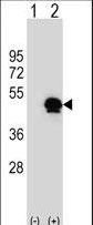 Western blot of SERPINE1 (arrow) using rabbit polyclonal SERPINE1 Antibody. 293 cell lysates (2 ug/lane) either nontransfected (Lane 1) or transiently transfected (Lane 2) with the SERPINE1 gene.