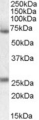 Antibody (0.1 ug/ml) staining of Human Duodenum lysate (35 ug protein in RIPA buffer). Primary incubation was 1 hour. Detected by chemiluminescence.