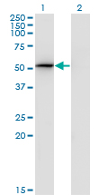 Western Blot analysis of PSMD4 expression in transfected 293T cell line by PSMD4 monoclonal antibody (M01), clone 3C9.Lane 1: PSMD4 transfected lysate(40.7 KDa).Lane 2: Non-transfected lysate.