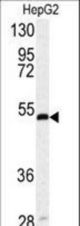 Western blot of SERPINH1 antibody in HepG2 cell line lysates (35 ug/lane). SERPINH1 (arrow) was detected using the purified antibody.