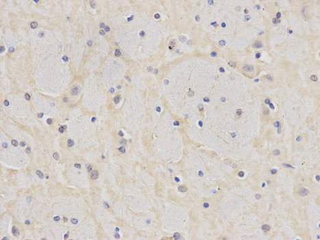 Immunohistochemistry of paraffin-embedded rat brain using PSMD4 antibody at dilution of 1:200 (400x lens).