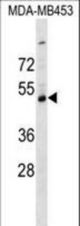 SERPINI2 Antibody western blot of MDA-MB453 cell line lysates (35 ug/lane). The SERPINI2 antibody detected the SERPINI2 protein (arrow).