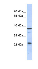 SERTAD1 antibody LS-C109894 Western blot of Fetal Muscle lysate.