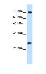 Jurkat cell lysate. Antibody concentration: 5.0 ug/ml. Gel concentration: 12%.