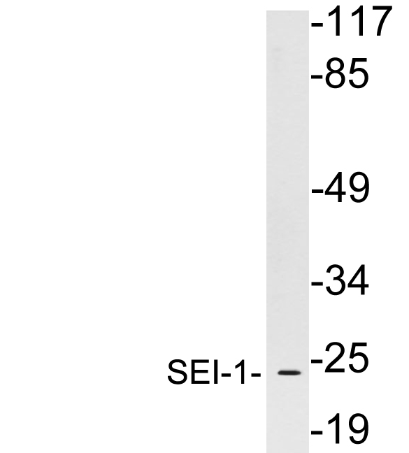 Western blot of extracts from Jurkat cells, using SEI-1 antibody.