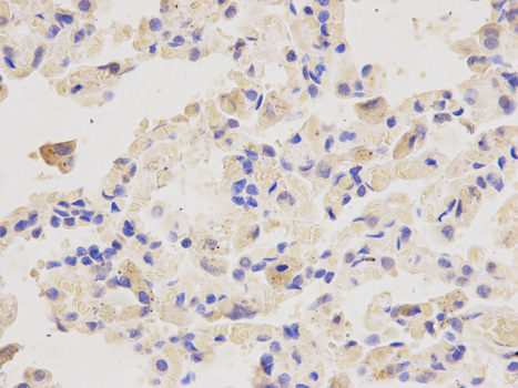 Immunohistochemistry of paraffin-embedded human lung using PSMD4 antibody at dilution of 1:200 (400x lens).