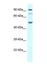 SESN2 antibody LS-C145458 Western blot of Fetal Heart lysate. Antibody concentration 1 ug/ml.