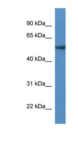 SESN2 antibody LS-C135840 Western blot of MCF7 cell lysate.