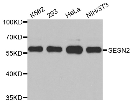 Western blot analysis of extracts of various cell lines, using SESN2 antibody.