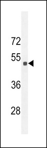 Western blot of Sestrin-2 Antibody in 293 cell line lysates (35 ug/lane). Sestrin-2 (arrow) was detected using the purified antibody..