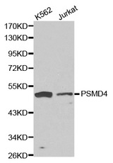 Western blot analysis of K562 cell and Jurkat cell lysate using PSMD4 antibody.