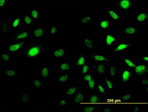 Immunofluorescence of monoclonal antibody to SES2 on HeLa cell (antibody concentration 10 ug/ml).