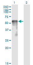Western blot of SESN2 expression in transfected 293T cell line by SESN2 monoclonal antibody (M03), clone 3B8.