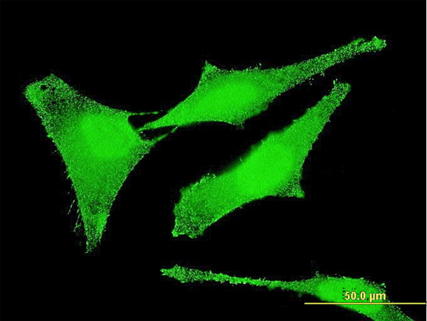 Immunofluorescence of monoclonal antibody to SET on HeLa cell . [antibody concentration 10 ug/ml]