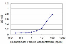 Detection limit for recombinant GST tagged SET is approximately 3 ng/ml as a capture antibody.