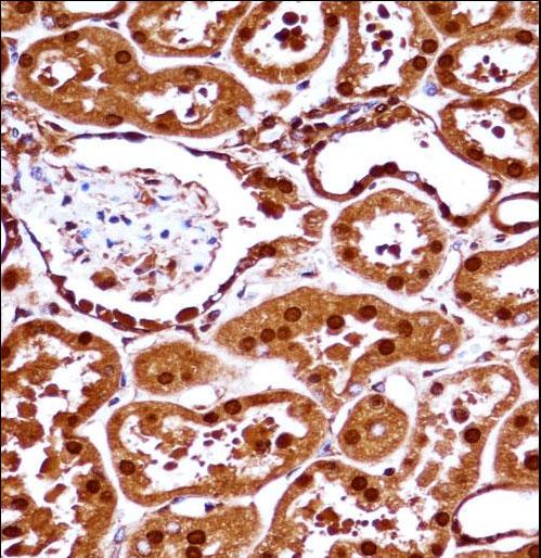SET Antibody immunohistochemistry of formalin-fixed and paraffin-embedded human kidney tissue followed by peroxidase-conjugated secondary antibody and DAB staining.