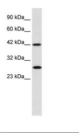 Raji Cell Lysate