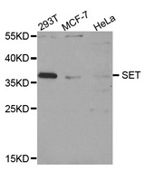 Western blot analysis of extracts of various cell lines, using SET antibody.
