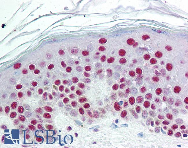 Anti-SET antibody IHC of human skin. Immunohistochemistry of formalin-fixed, paraffin-embedded tissue after heat-induced antigen retrieval. Antibody LS-B2058 concentration 10 ug/ml.