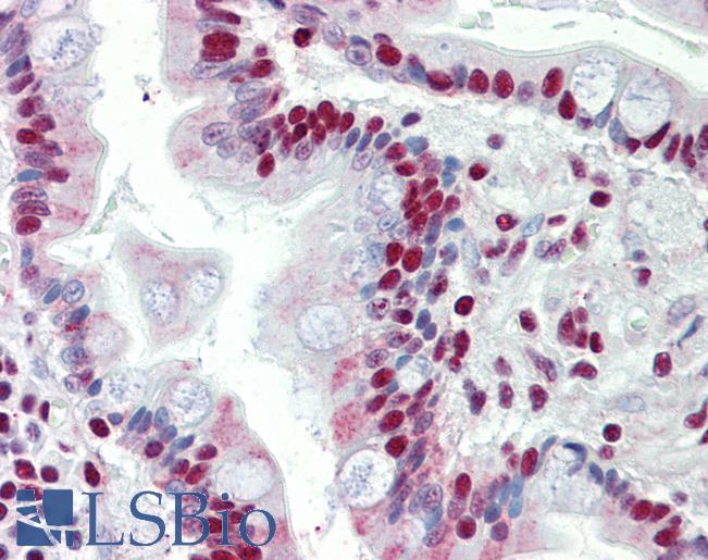 Anti-SET / TAF-I antibody IHC staining of human small intestine. Immunohistochemistry of formalin-fixed, paraffin-embedded tissue after heat-induced antigen retrieval.