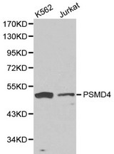 Western blot of PSMD4 pAb in extracts from K562 and Jurkat cells.