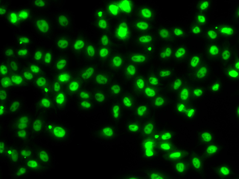 Immunofluorescence blot of MCF7 cell using SETBP1 antibody.