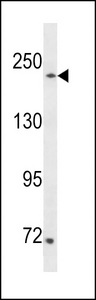 SETD1A Antibody western blot of 293 cell line lysates (35 ug/lane). The SETD1A antibody detected the SETD1A protein (arrow).