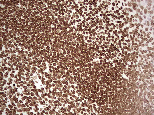 IHC of paraffin-embedded Human tonsil using anti-SETD1A mouse monoclonal antibody. (Heat-induced epitope retrieval by 1 mM EDTA in 10mM Tris, pH8.5, 120°C for 3min).
