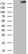 HEK293T cells were transfected with the pCMV6-ENTRY control (Left lane) or pCMV6-ENTRY SETD1A (Right lane) cDNA for 48 hrs and lysed. Equivalent amounts of cell lysates (5 ug per lane) were separated by SDS-PAGE and immunoblotted with anti-SETD1A.