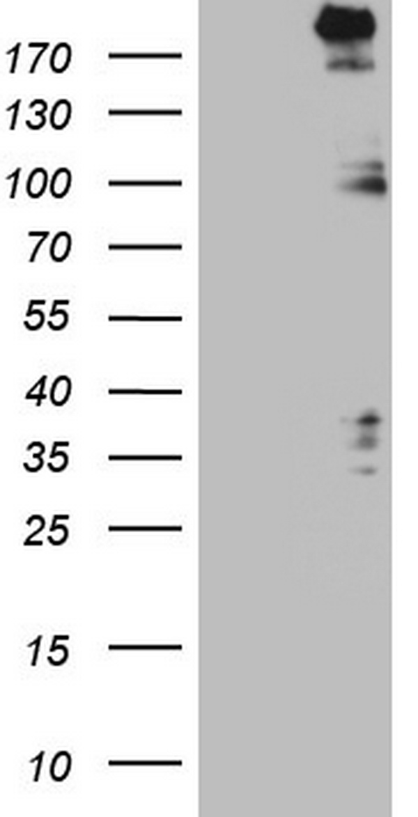 HEK293T cells were transfected with the pCMV6-ENTRY control (Left lane) or pCMV6-ENTRY SETD1A (Right lane) cDNA for 48 hrs and lysed. Equivalent amounts of cell lysates (5 ug per lane) were separated by SDS-PAGE and immunoblotted with anti-SETD1A.